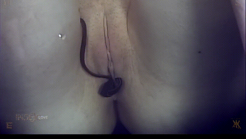 [혐] HARD_거머리 보지/항문_물고문 미리보기 13