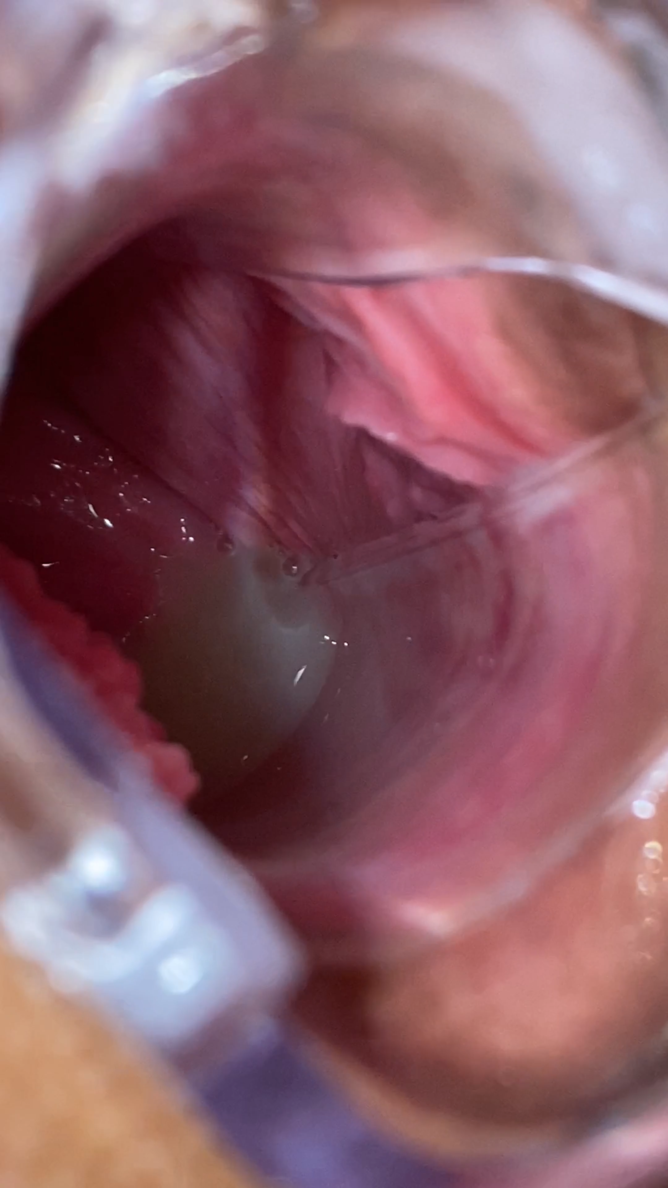 슬랜더 복근 걸레녀 백인 초대남 풀버전 & 질싸 후 질경으로 확인 미리보기 4