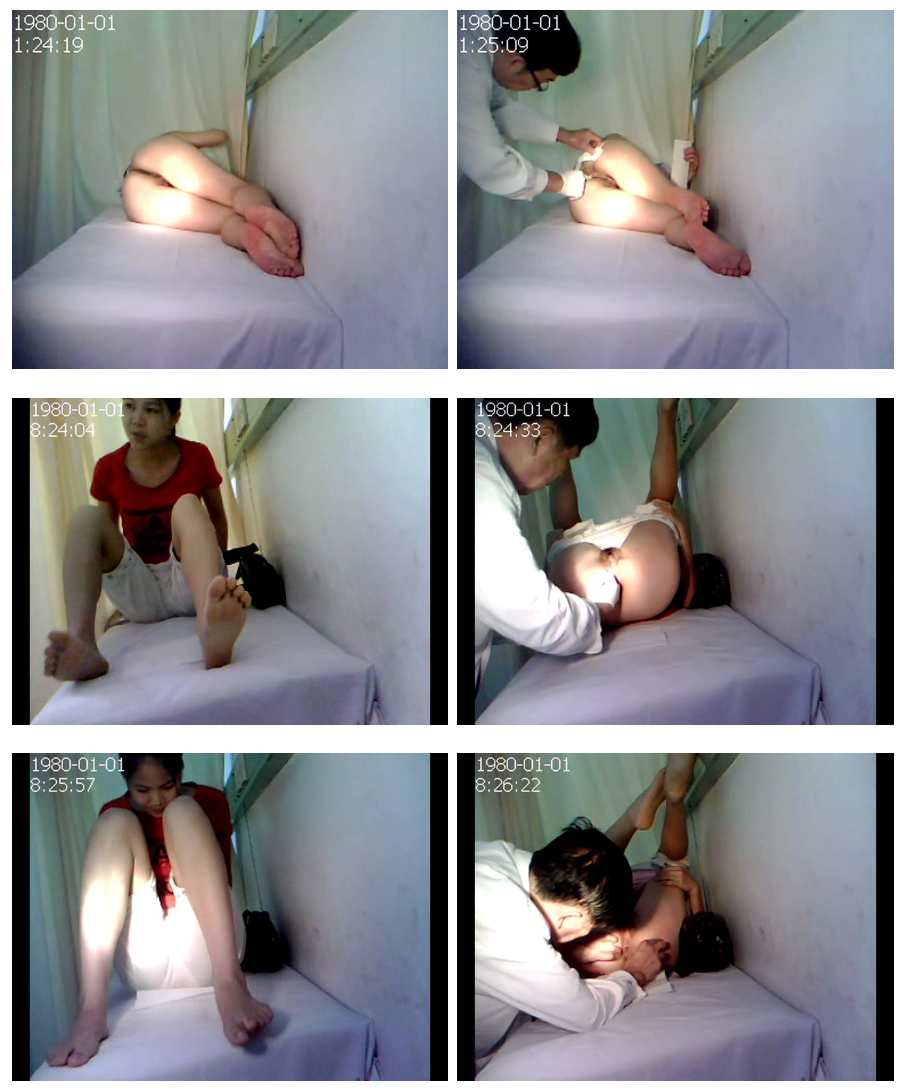 비뇨기과_여성 보지/항문 진료