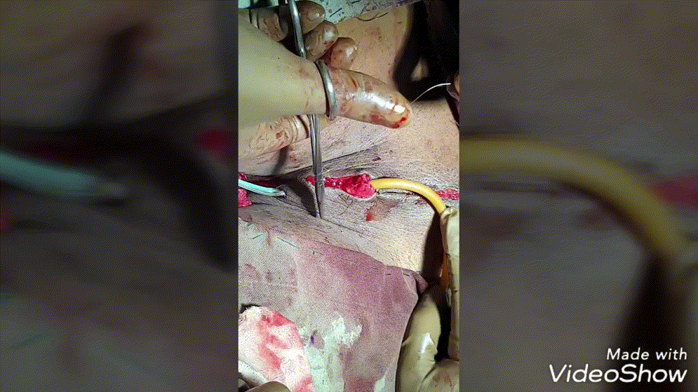 시청주의 ★ [극혐] 성전환 수술장면 7V 미리보기 10