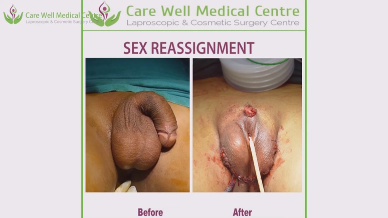 시청주의 ★ [극혐] 성전환 수술장면 7V 미리보기 12