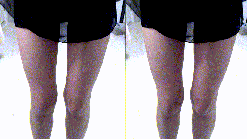 보율_패치흑두 [일방/500개팬방/비번방 5v] 미리보기 3