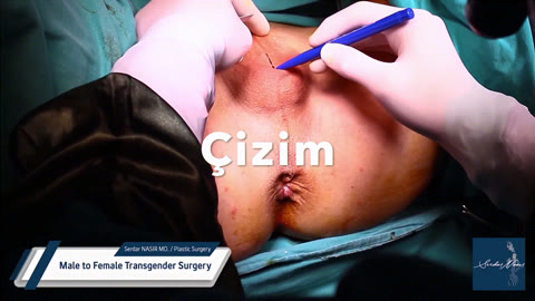 시청주의 ★ [극혐] 성전환 수술장면 7V